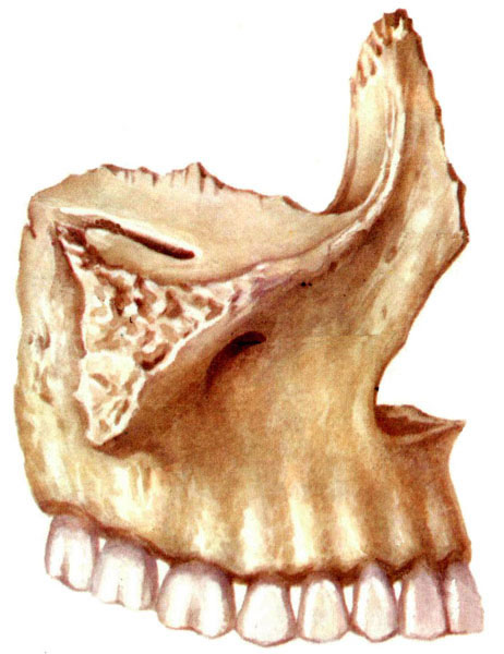人体上颌骨解剖示意图-人体解剖图