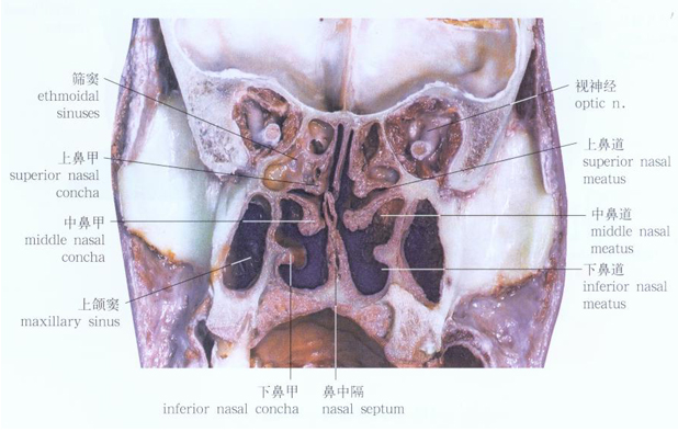 鼻道窦口复合体解剖图片