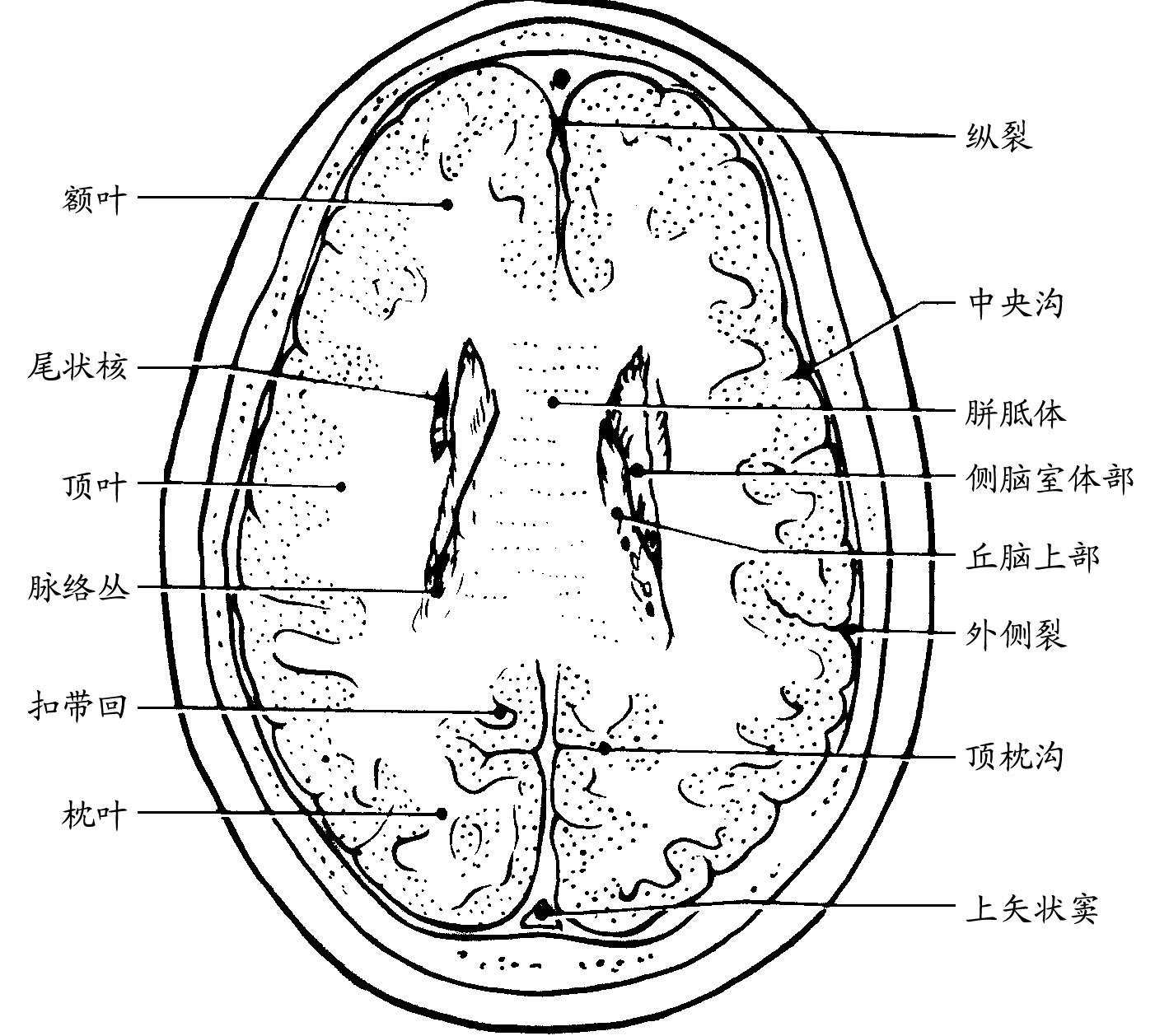 侧脑室体表定位图片