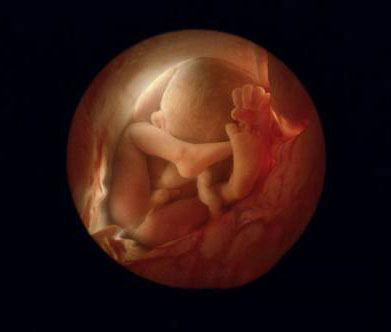 怀孕72天的胎儿清晰图图片